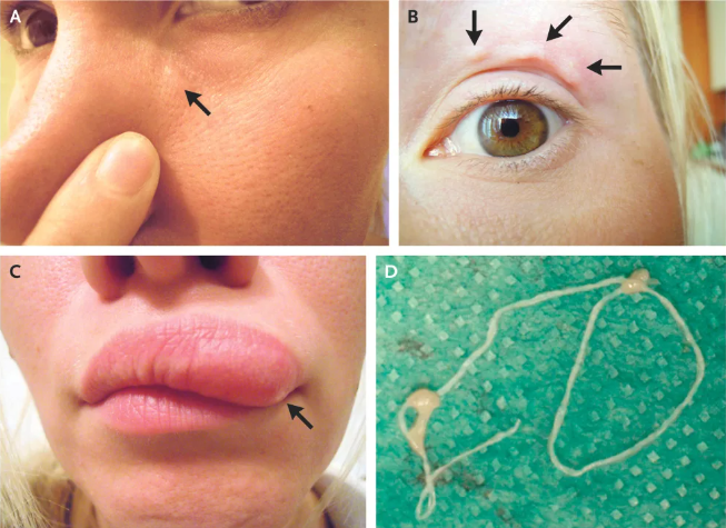 What Doctors Found On Woman's Face Is Horrifying