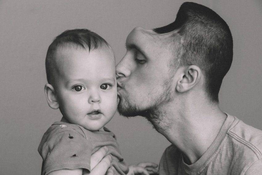 California Father Loses Skull Fragment Due to Excessive Energy Drink Consumption