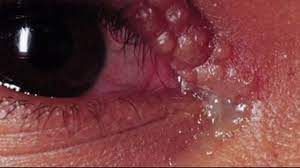 THE TRUTH Behind Contracting Herpes at Makeup Counters - Shocking Story